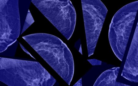 How mammograms could transform to predict the future