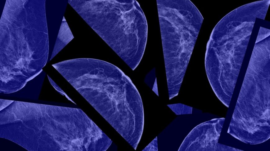 How mammograms could transform to predict the future